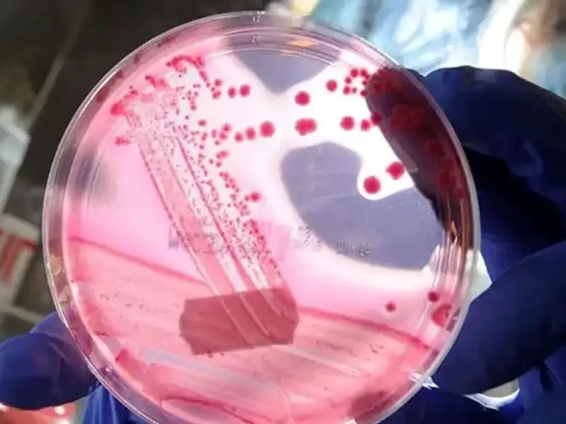 Yaşlanmayı Unutmanın Yolu: AP2A1 Proteini Üzerine Şaşırtıcı Keşif