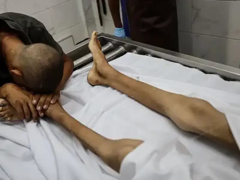 Gazze’de Açlık Felaketi: Bir Çocuk Daha Hayata Veda Etti!