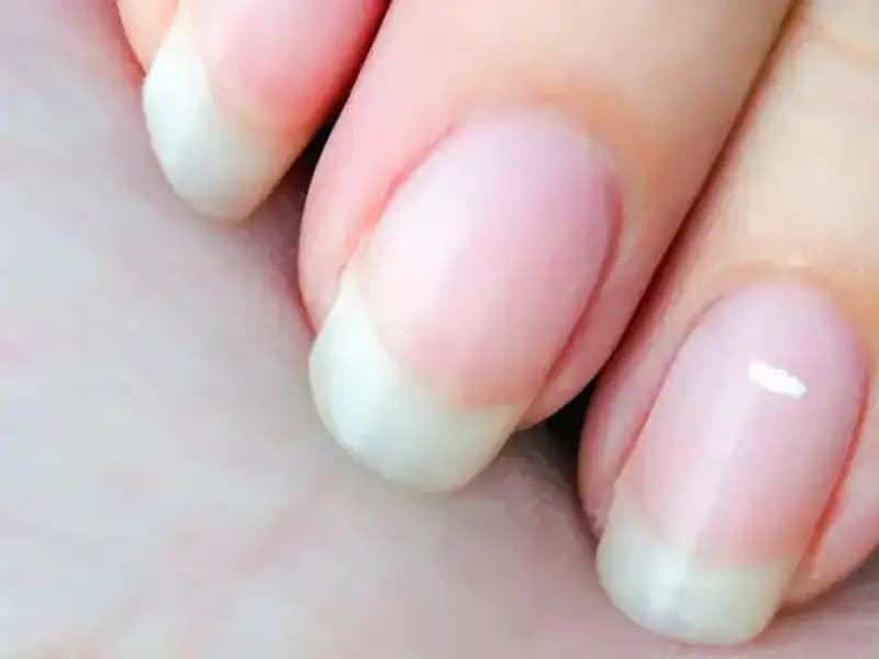 Tırnaklarınız Size Kalan Süreyi Anlatıyor mu? Uzmanların Görüşleri