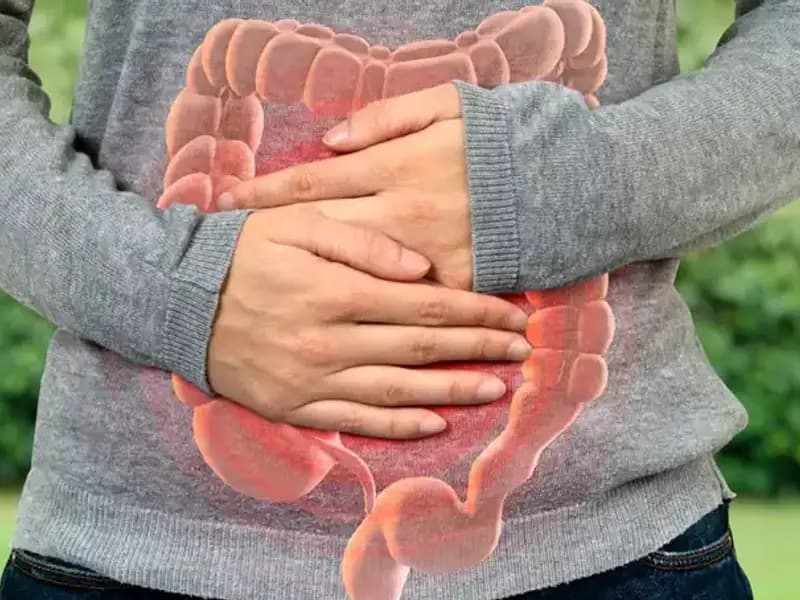 Bağırsak Kanserini Önlemenin Yolu: Kolorektal Cerrahından Önemli Tavsiyeler