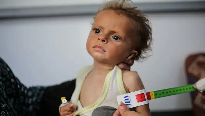 İngiltere, 300 Gazze'li Çocuğa Yeni Bir Yaşam Fırsatı Sunacak