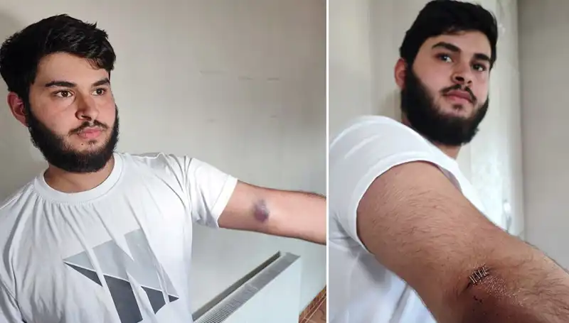 Evlinin Bahçesine Kaçan Top, Mahallenin Huzurunu Bozdu