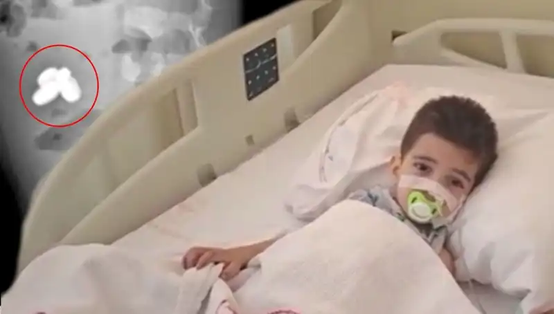 4 Yaşındaki Çocuk Pil ve Mıknatıs Yutarak Hayati Tehlike Atlattı